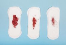 Coágulos na menstruação Normal ou sinal de alerta