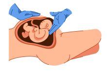 O que ninguém te conta sobre a cesárea… e que toda mulher deveria saber