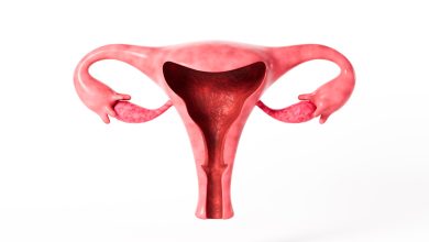 5 vilões da sua rotina que pioram a endometriose