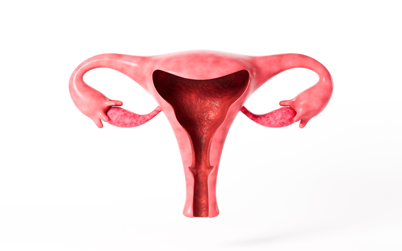 5 vilões da sua rotina que pioram a endometriose