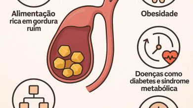 5 causas da pedra na vesícula que você precisa conhecer agora