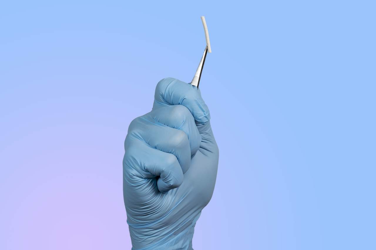 Implanon o anticoncepcional que dura até 3 anos