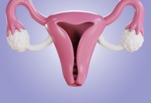 Laqueadura 3 mitos que ainda confundem muitas mulheres