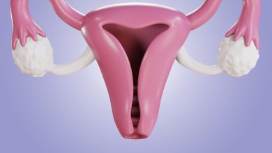 Laqueadura 3 mitos que ainda confundem muitas mulheres