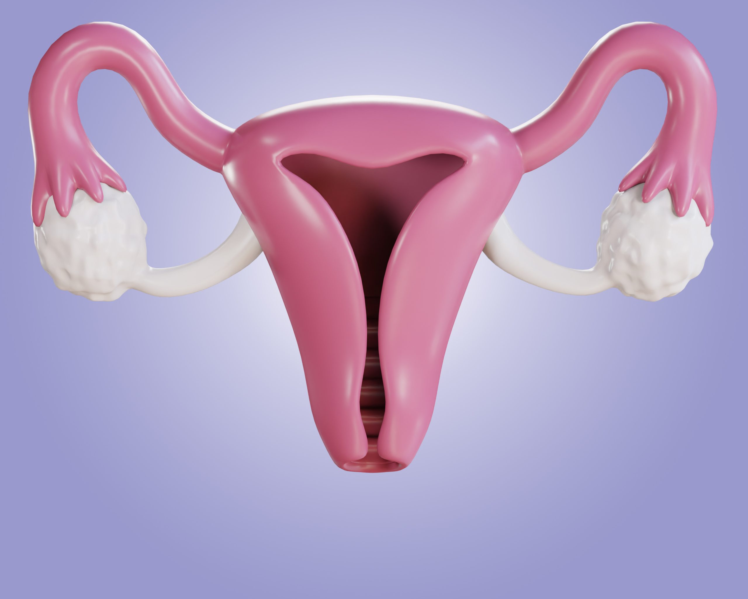 Laqueadura 3 mitos que ainda confundem muitas mulheres