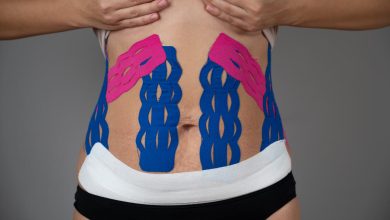 Taping no pós-parto: uma aliada na recuperação da mulher