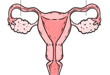 Laqueadura você ainda tem dúvidas se pode fazer