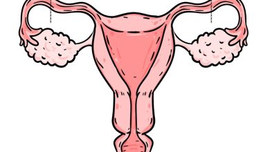 Laqueadura você ainda tem dúvidas se pode fazer