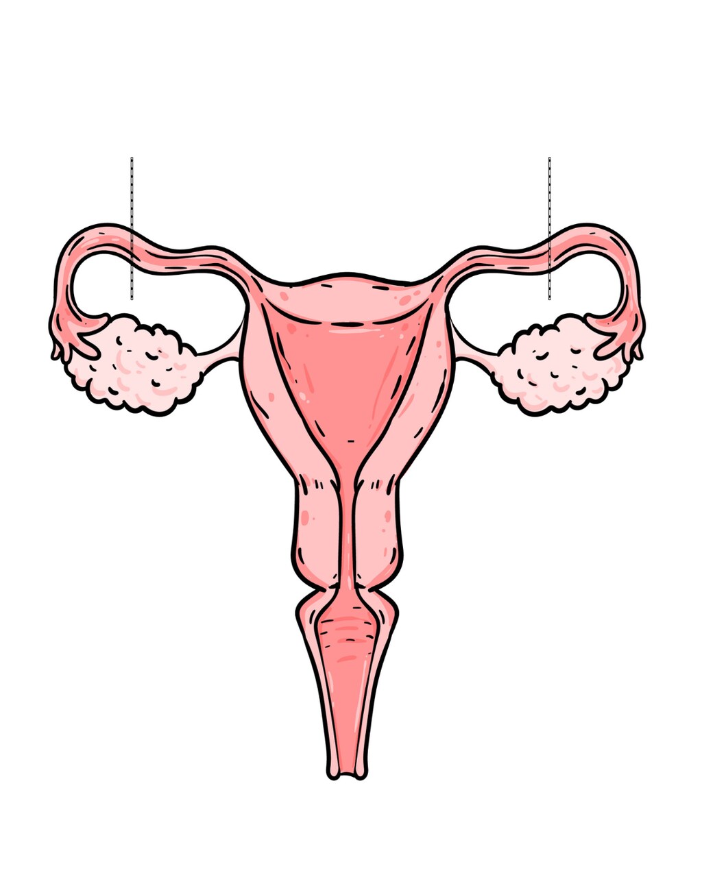 Laqueadura você ainda tem dúvidas se pode fazer