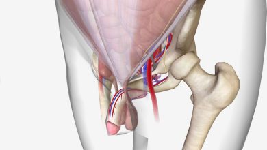 Hérnia inguinal não é tudo igual e entender isso pode evitar complicações sérias
