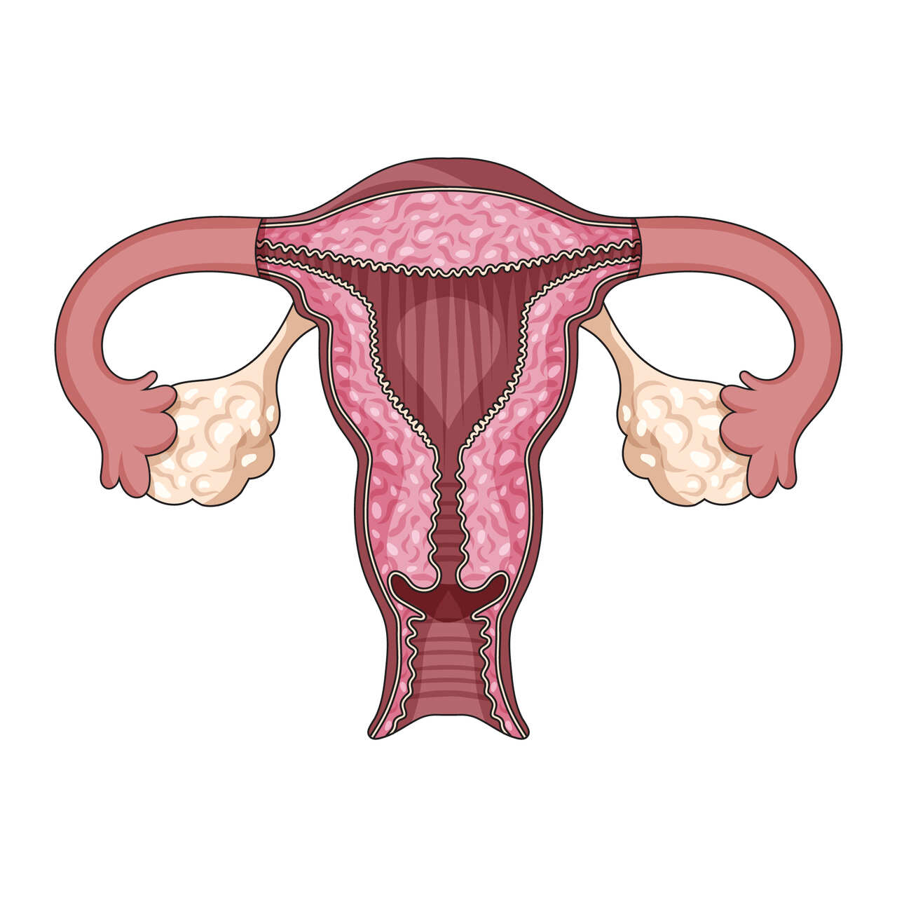 Nova lei da laqueadura muda tudo o que toda mulher precisa saber