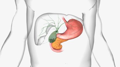 Pedra na vesícula não surge por acaso: entenda os fatores de risco